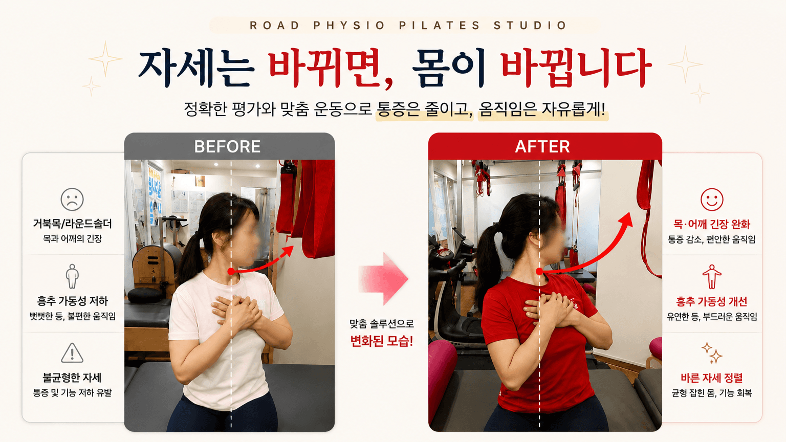 거북목 · 라운드숄더 자세 변화 전후 비교