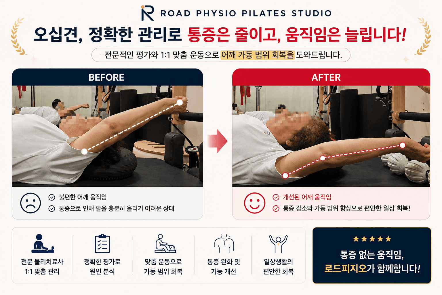 오십견의 어깨 통증 · 가동범위 변화 전후 비교
