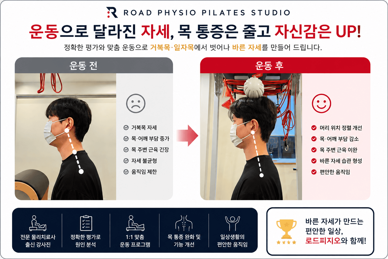 목 자세 교정을 통한 일상생활의 변화 전후 비교